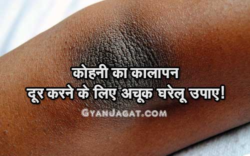कोहनी का कालापन दूर करने के लिए अचूक घरेलू उपाए!