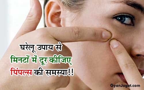 घरेलू उपाय से मिनटों में दूर कीजिए पिंपल्स की समस्या!!