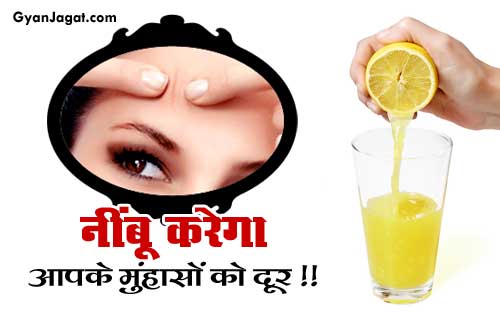 नींबू करेगा आपके मुंहासों को दूर !!