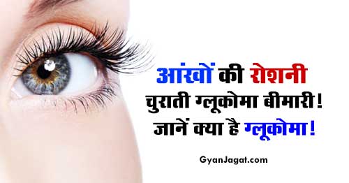 Information About Glaucoma Eye Disease in Hindi