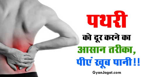 Kidney Stone Causes Home Remedies Treatment in Hindi