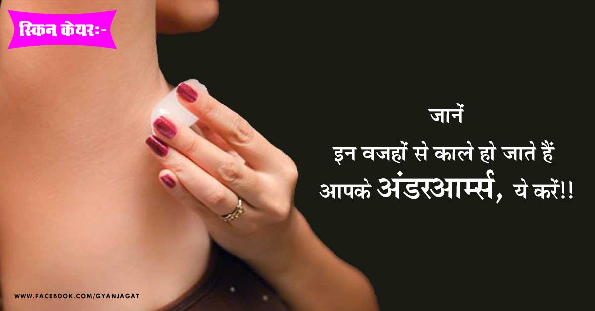 इन वजहों से काले हो जाते हैं आपके अंडरआर्म्स, ये करें!!