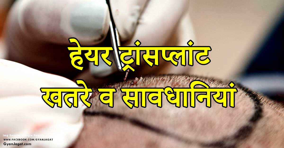 Hair Transplant Risk and Precautions in Hindi