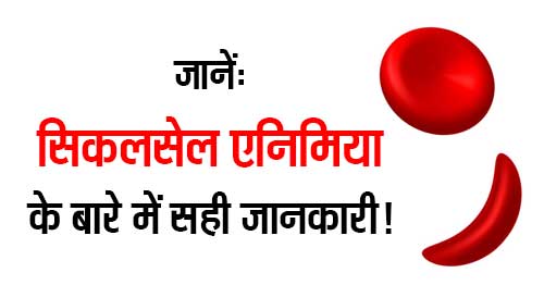 Sickle Cell Anemia Ke Bare Main Sahi Jankari