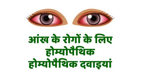 Homeopathic Medicine for Eye Disease in Hindi